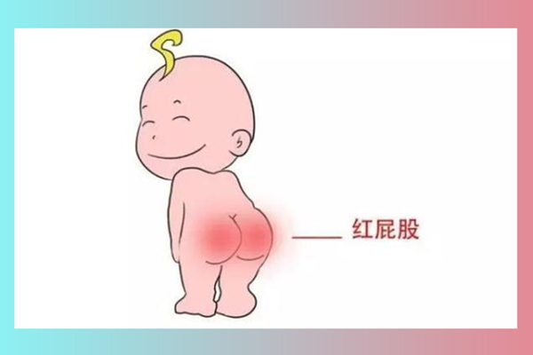 宝宝红屁股的原因_怎么预防和护理宝宝的红屁屁 - 月嫂面试常见问答(图1)